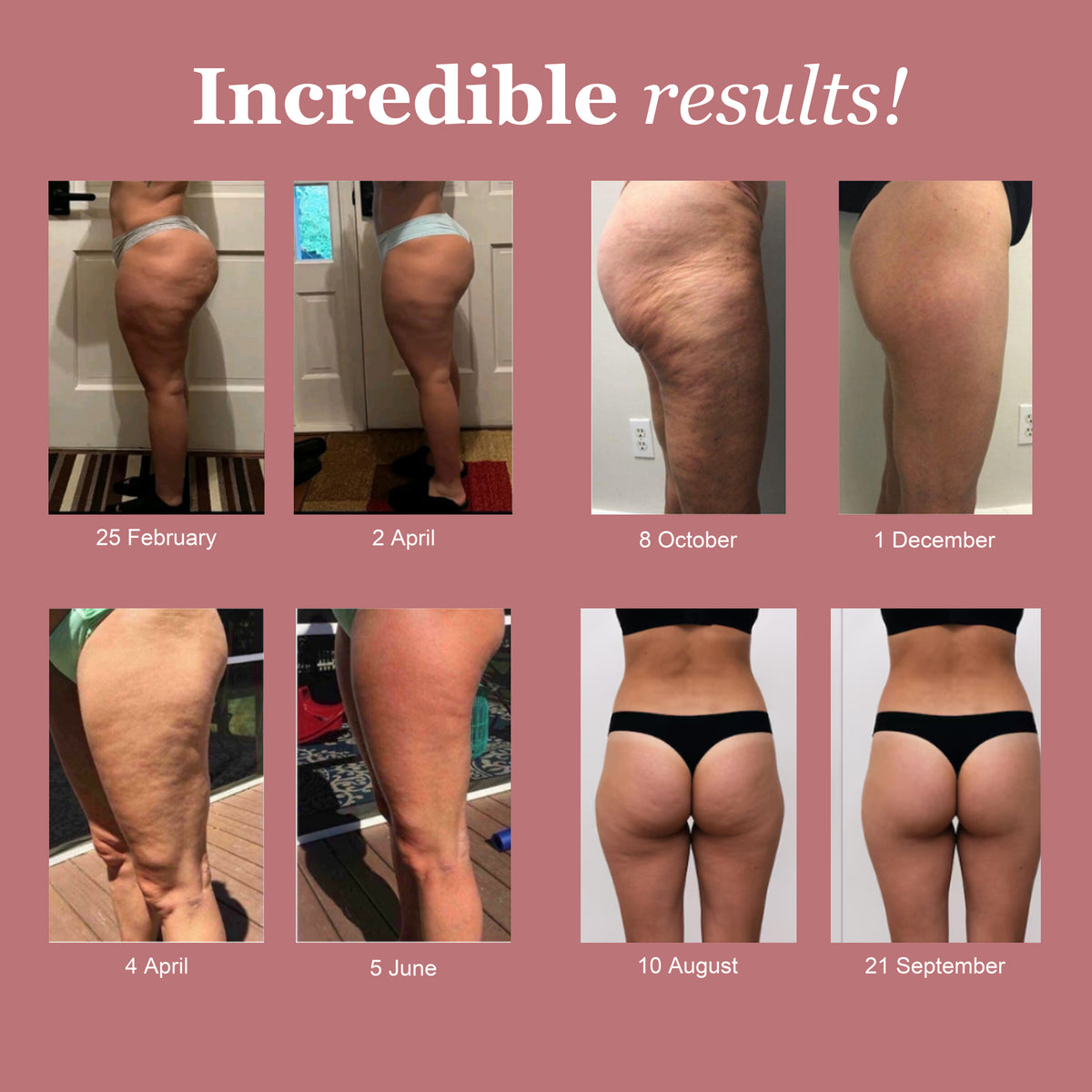 LUMIVE™ AUS 3D-Sculpting Compression Leggings