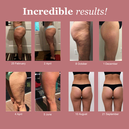 LUMIVE™ AUS 3D-Sculpting Compression Leggings